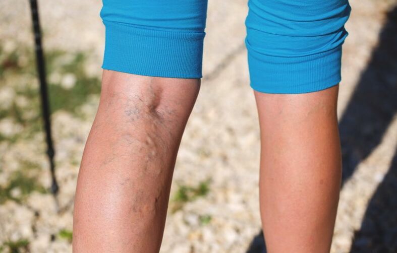 Danos às extremidades inferiores